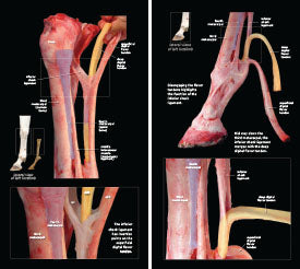 Tendons and Ligaments of the Equine Distal Limb